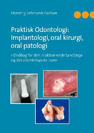 Praktisk odontologi: implantologi, oral kirurgi, oral patologi : håndbog for den praktiserende tandlæge og det odontologiske team