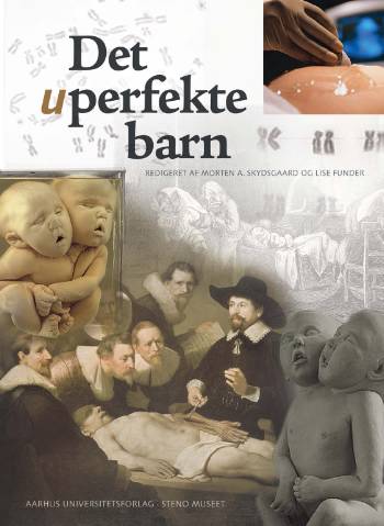 Det uperfekte barn