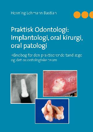 Praktisk odontologi: implantologi, oral kirurgi, oral patologi : håndbog for den praktiserende tandlæge og det odontologiske team