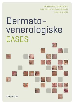 Dermato-venerologiske cases