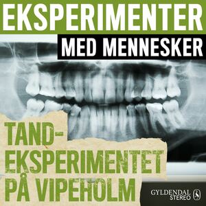 Eksperimenter med mennesker. 10 : Tandeksperimentet på Vipeholm