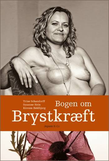 Bogen om brystkræft