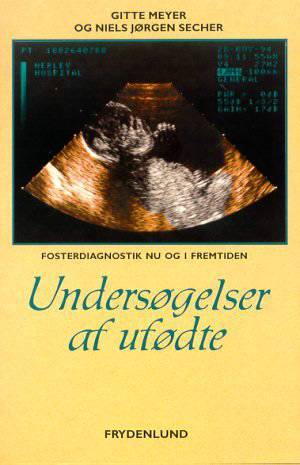 Undersøgelser af ufødte : fosterdiagnostik nu og i fremtiden