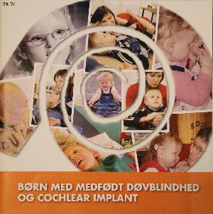 Børn med medfødt døvblindhed og Cochlear implant
